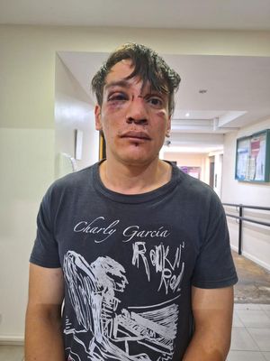 Matias Darabos golpeado